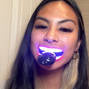 SMILE OPTICS All-In-One LED Teeth Whitening Kit